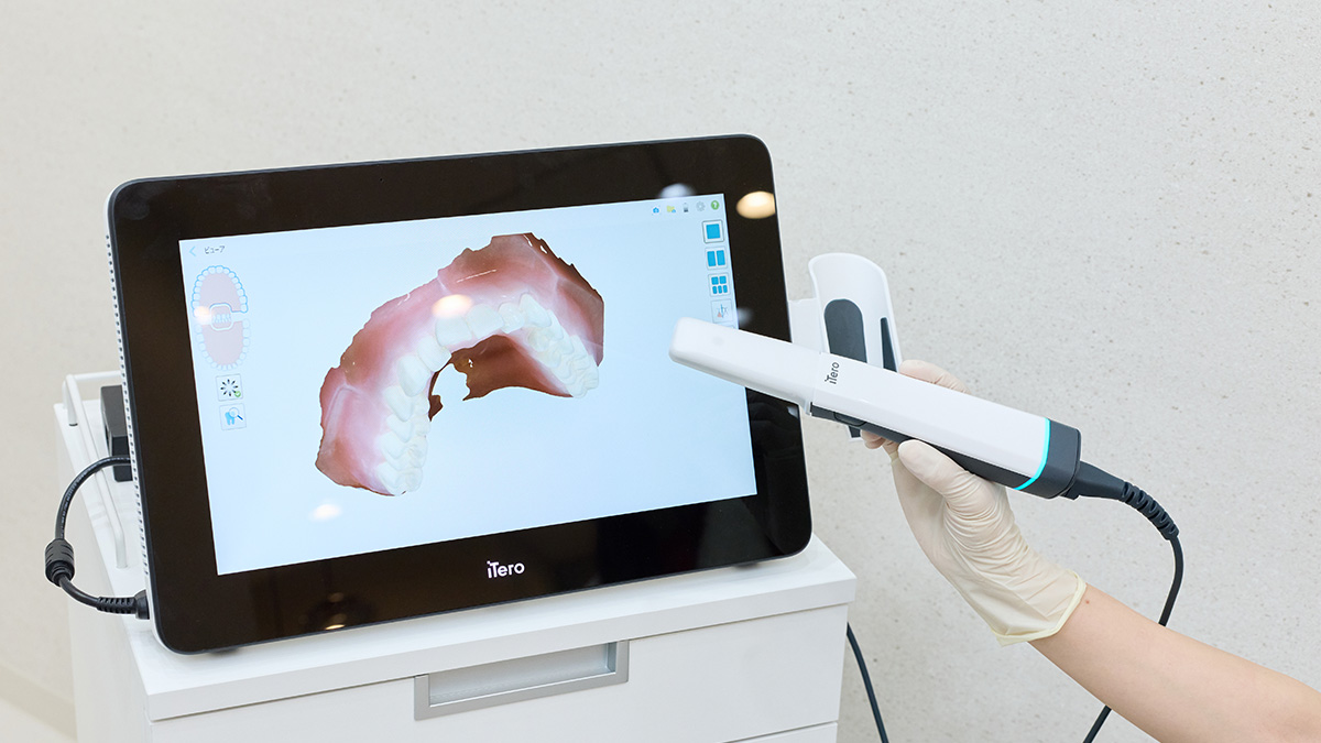 iTero（口腔内スキャナー）