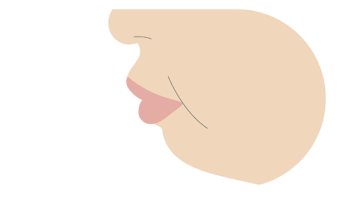 口ゴボ（上下顎前突）の横顔のイメージ