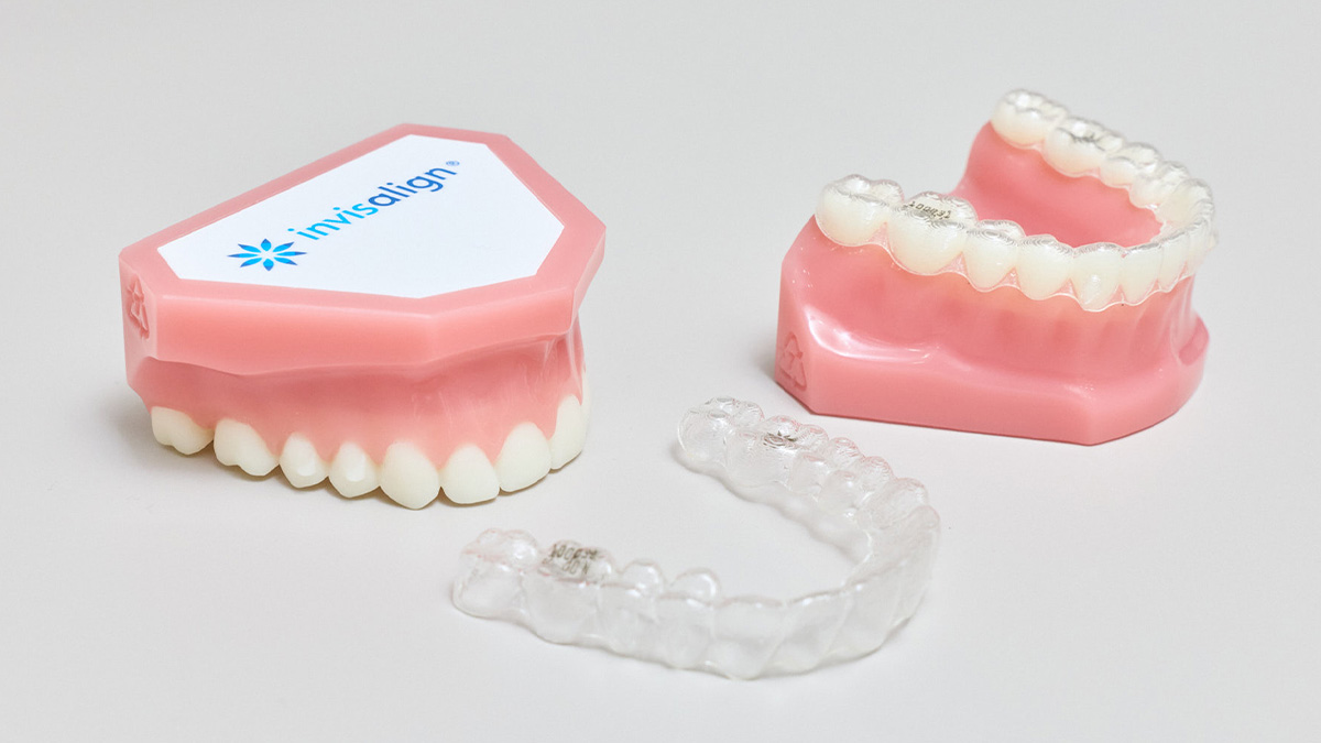 インビザラインによる叢生の矯正治療