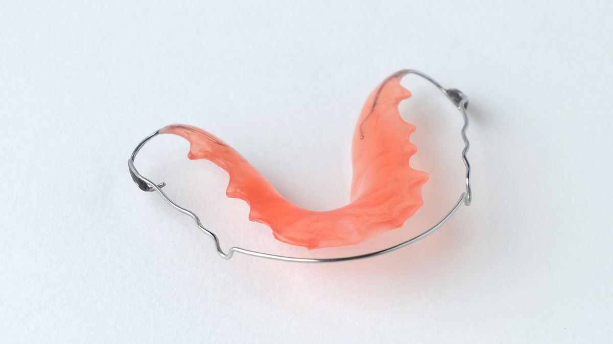 矯正治療後の保定装置（リテーナー）のイメージ