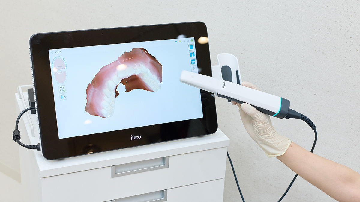 口腔内スキャナーによるデジタル診断の様子