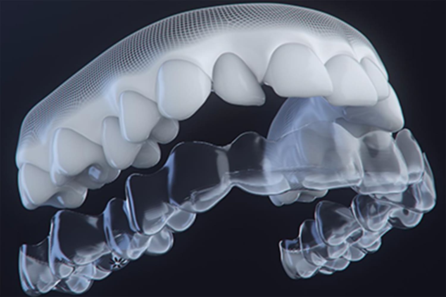 マウスピース型矯正（インビザライン）