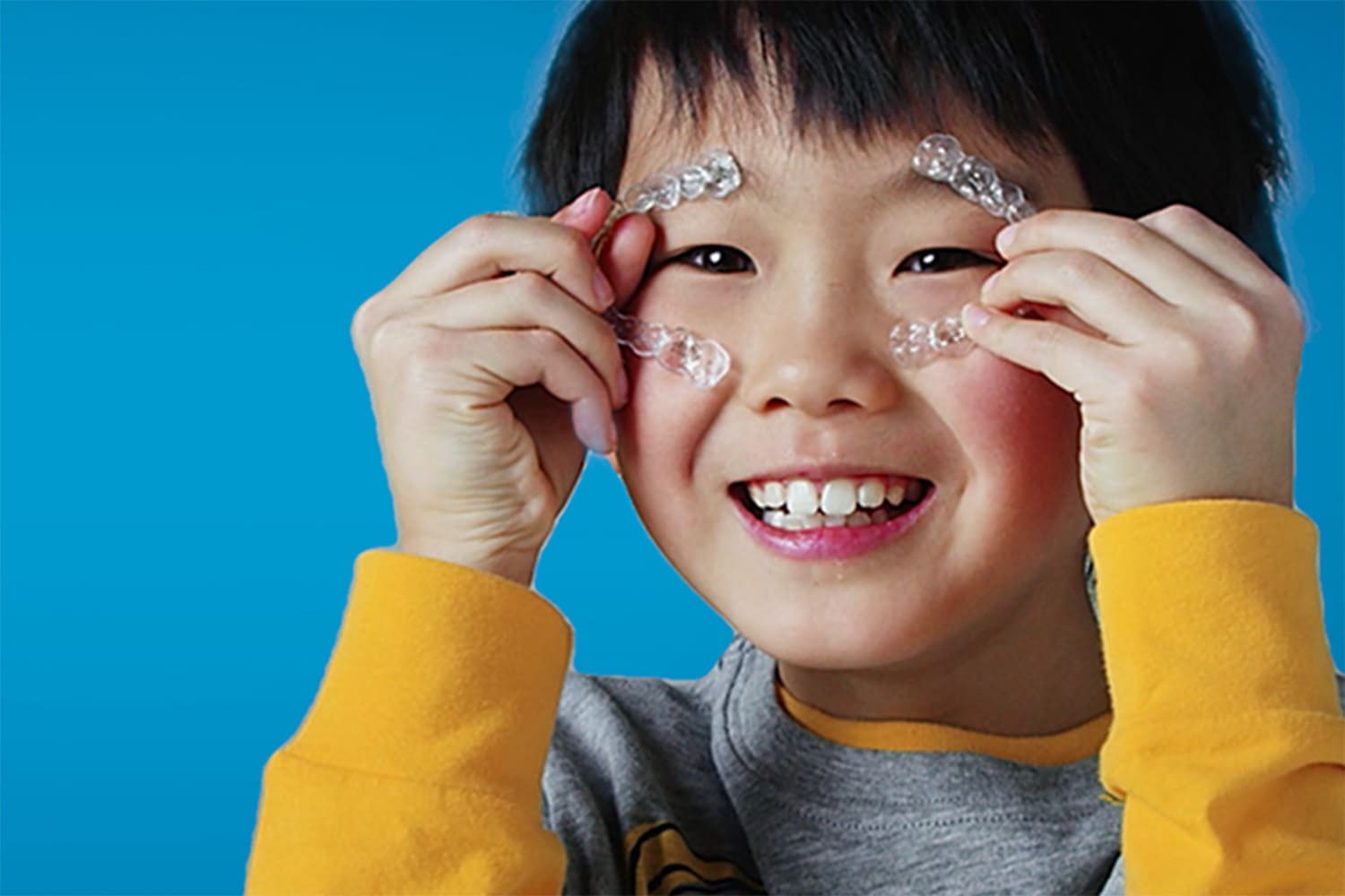 マウスピース矯正